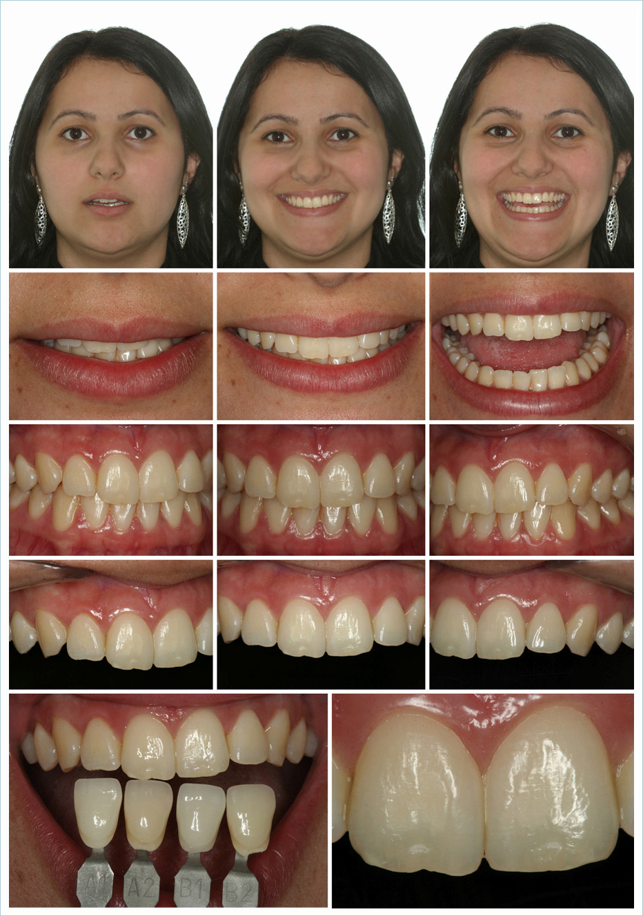 calgaro-protocolo-de-trabalho